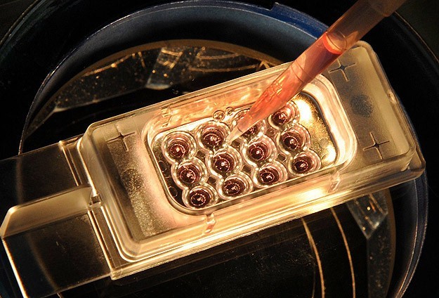 Türkiye Tümöre Müdahalenin Merkezi Olacak